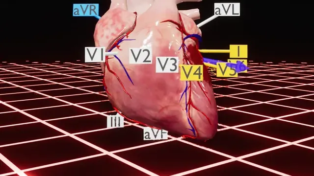 ER-cade cover
