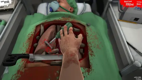 Surgeon Simulator screenshot
